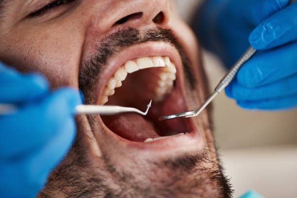 Best Pediatric Emergency Dentist in Upper Grand Lagoon, FL